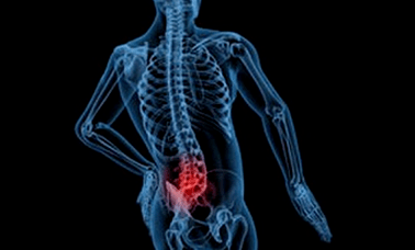 Razlozi razvoja lumbalne osteohondroze