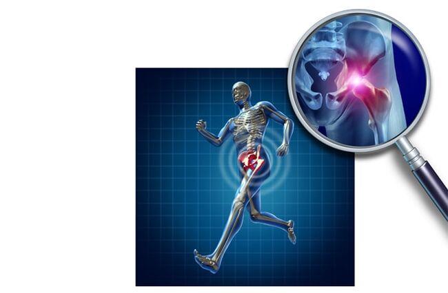 Bol pri trčanju u zglobu kuka